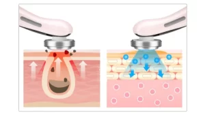 Ultrasonic Facial Cleansing Device 